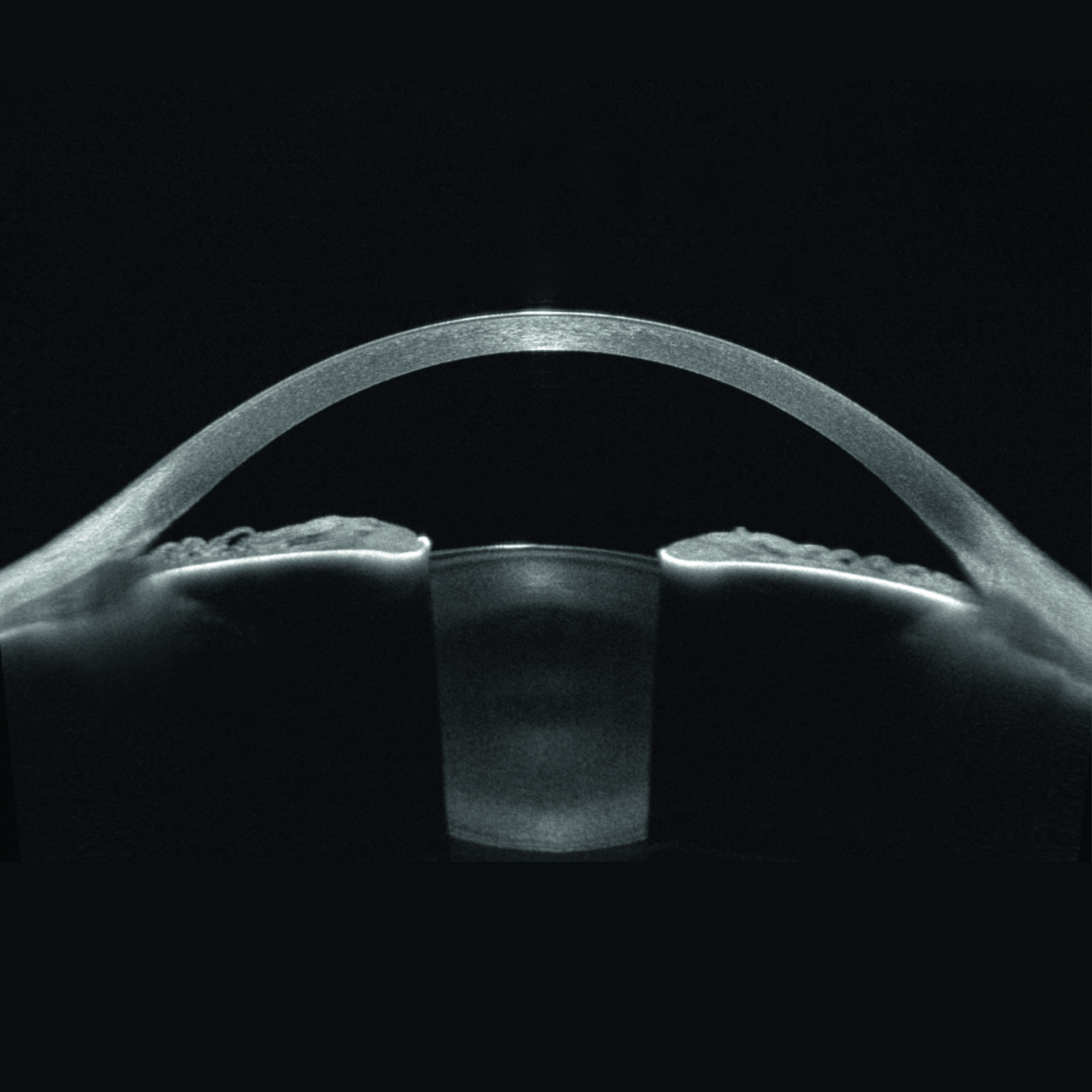 High-resolution visualization of the entire anterior segment, from the anterior surface of the cornea to the posterior surface of the lens.
