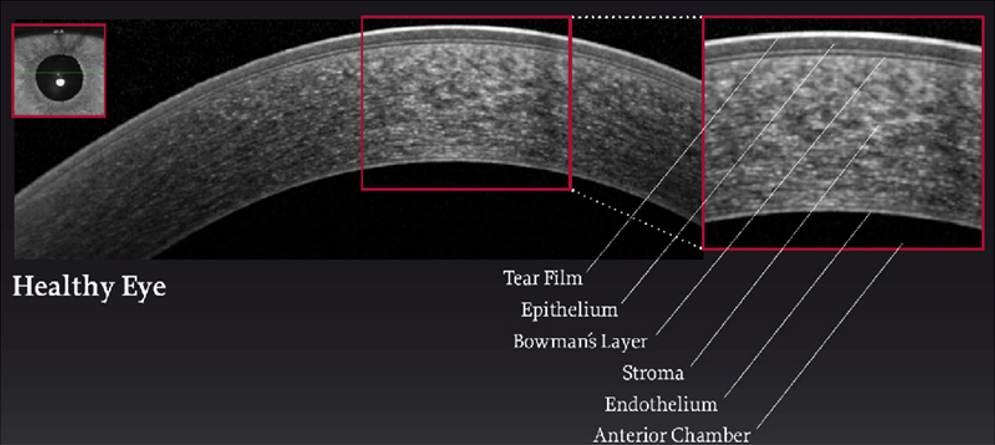 OCT of a normal cornea